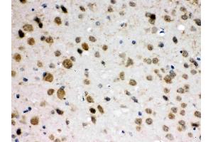 ABR was detected in paraffin-embedded sections of mouse brain tissues using rabbit anti- ABR Antigen Affinity purified polyclonal antibody (Catalog # ) at 1 µg/mL. (ABR 抗体  (Middle Region))
