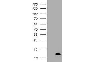 Image no. 1 for anti-Chromosome 17 Open Reading Frame 37 (C17orf37) antibody (ABIN1501783) (C17orf37 抗体)