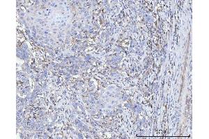 IHC analysis of FACL4/ACSL4 using anti-FACL4/ACSL4 antibody (ABIN7602779).