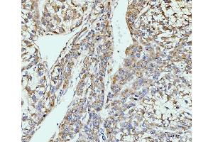 IHC analysis of GIT1 using anti-GIT1 antibody (ABIN7601683). (GIT1 抗体  (AA 415-736))