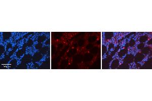 Rabbit Anti-CDK6 Antibody  AV Formalin Fixed Paraffin Embedded Tissue: Human Bone Marrow Tissue Observed Staining: Cytoplasm, Nucleus Primary Antibody Concentration: 1:100 Other Working Concentrations: N/A Secondary Antibody: Donkey anti-Rabbit-Cy3 Secondary Antibody Concentration: 1:200 Magnification: 20X Exposure Time: 0. (CDK6 抗体  (C-Term))