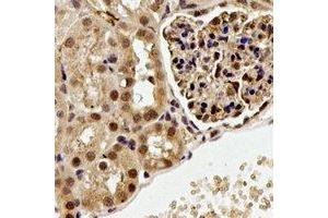Immunohistochemical analysis of ALG-2 staining in rat kidney formalin fixed paraffin embedded tissue section. (ALG2 抗体)