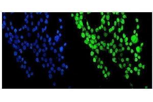 IF analysis of NUP214 using anti-NUP214 antibody (ABIN7601473). (NUP214 抗体  (AA 36-374))