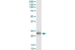 TPT1 monoclonal antibody (M03), clone 2C4. (TPT1 抗体  (AA 35-138))