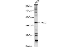 Western blot analysis of extracts of PC-3 cells, using HY antibody  at 1:500 dilution. (HYAL1 抗体  (AA 136-435))