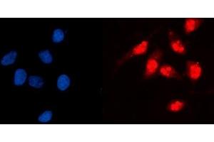 IF analysis of GCKR using anti-GCKR antibody (ABIN7602493). (GCKR 抗体  (AA 8-569))