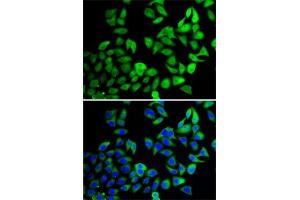 Immunofluorescence analysis of A-549 cells using USP8 antibody (ABIN6132776, ABIN6150035, ABIN6150036 and ABIN6222811).