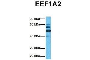 Western Blotting (WB) image for anti-Eukaryotic Translation Elongation Factor 1 alpha 2 (EEF1A2) (Middle Region) antibody (ABIN2783277)