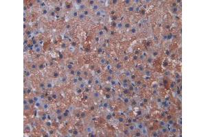 Used in DAB staining on fromalin fixed paraffin- embedded Kidney tissue (CYP11A1 抗体  (AA 392-521))