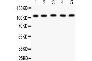 Anti- MSH2 Picoband antibody, Western blotting All lanes: Anti MSH2  at 0. (MSH2 抗体  (AA 337-583))