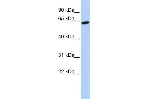 WB Suggested Anti-ZNF133 Antibody Titration:  0.
