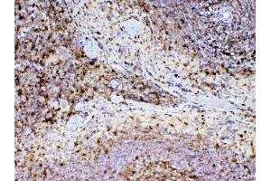 IHC analysis of ADA using anti-ADA antibody .