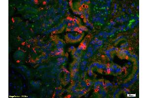 Immunofluorescence (IF) image for anti-Angiotensin II Receptor, Type 2 (AGTR2) antibody (ABIN668616)