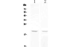Western Blotting (WB) image for anti-Tumor Necrosis Factor Receptor Superfamily, Member 17 (TNFRSF17) (AA 1-54) antibody (ABIN5692955)