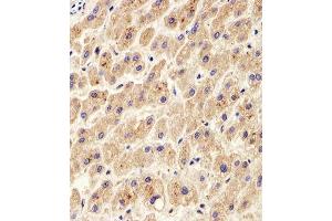 Immunohistochemistry (Paraffin-embedded Sections) (IHC (p)) image for anti-Protein Disulfide Isomerase Family A, Member 6 (PDIA6) (AA 144-172) antibody (ABIN390608)