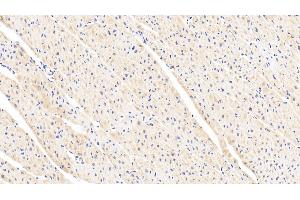 Detection of LEP in Human Cardiac Muscle Tissue using Polyclonal Antibody to Leptin (LEP) (Leptin 抗体  (AA 22-167))