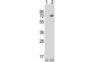Western blot analysis of XRCC6 antibody and 293 cell lysate either nontransfected (Lane 1) or transiently transfected (2) with the XRCC6 gene.