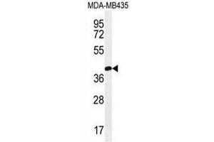 CLDN16 Antibody (N-term) western blot analysis in MDA-MB435 cell line lysates (35µg/lane).