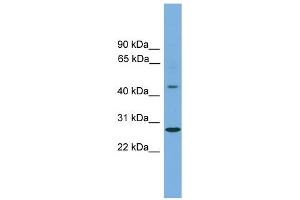 WB Suggested Anti-ZNF514 Antibody Titration:  0. (ZNF514 抗体  (Middle Region))