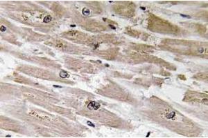 Immunohistochemistry analysisof BMP-2 Antibody in paraffin-embedded human heart tissue. (BMP2 抗体)