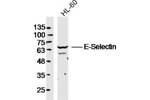 Western Blotting (WB) image for anti-Selectin E (SELE) (AA 501-612) antibody (ABIN674244)