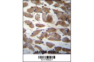 ACTN3 Antibody immunohistochemistry analysis in formalin fixed and paraffin embedded human skeletal muscle followed by peroxidase conjugation of the secondary antibody and DAB staining.