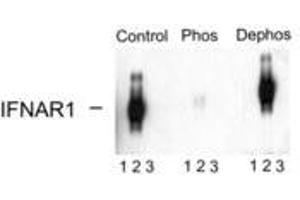 Image no. 1 for anti-Interferon alpha/beta Receptor 1 (IFNAR1) (pSer535), (Ser539) antibody (ABIN228236) (IFNAR1 抗体  (pSer535, Ser539))