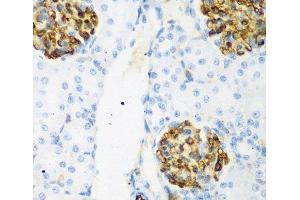 Immunohistochemistry of paraffin-embedded Rat kidney using CSRNP1 Polyclonal Antibody at dilution of 1:200 (40x lens). (AXUD1 抗体)