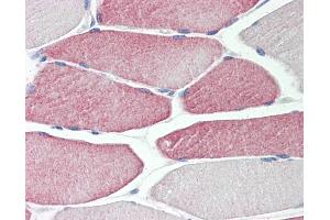 Immunohistochemistry (IHC) image for anti-Cytochrome P450, Family 2, Subfamily D, Polypeptide 6 (CYP2D6) (AA 268-457) antibody (ABIN467616)