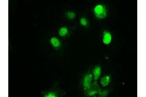 Image no. 4 for anti-Checkpoint Kinase 2 (CHEK2) antibody (ABIN1497496)