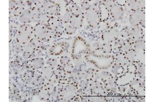 Immunoperoxidase of monoclonal antibody to PBX1 on formalin-fixed paraffin-embedded human salivary gland. (PBX1 抗体  (AA 213-321))