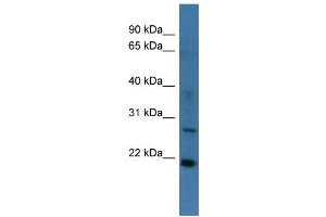 WB Suggested Anti-STARD4 Antibody Titration: 0. (STARD4 抗体  (Middle Region))