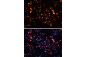 Immunofluorescence analysis of 293T cells using Mouse anti GFP-Tag mAb. (GFP 抗体  (AA 1-100))