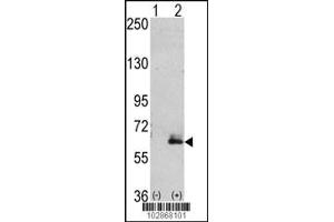 Western blot analysis of hMAP2-Q425 using rabbit polyclonal hMAP2-Q425 Antibody using 293 cell lysates (2 ug/lane) either nontransfected (Lane 1) or transiently transfected with the hMAP2-Q425 gene (Lane 2). (MAP2 抗体  (C-Term))