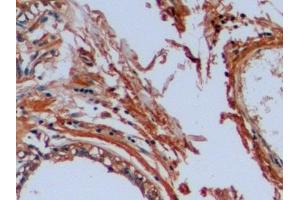 Detection of OCT4 in Human Mammary gland Tissue using Polyclonal Antibody to Octamer Binding Transcription Factor 4 (OCT4) (OCT4 抗体  (AA 136-360))