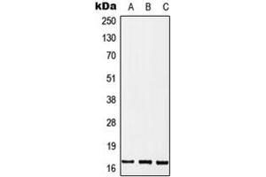 Western blot analysis of MGST2 expression in MCF7 (A), SP2/0 (B), PC12 (C) whole cell lysates. (MGST2 抗体  (Center))