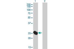 Lane 1: ARG1 transfected lysate ( 26. (ARG1 293T Cell Transient Overexpression Lysate(Denatured))