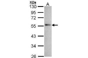 WB Image Sample (30 ug of whole cell lysate) A: A431 , 10% SDS PAGE antibody diluted at 1:1000 (Annexin A11 抗体  (N-Term))