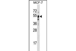 Western Blotting (WB) image for anti-SET Domain Containing (Lysine Methyltransferase) 7 (SETD7) (AA 159-189) antibody (ABIN387997)