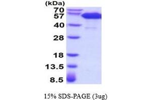 SDS-PAGE (SDS) image for Tumor Necrosis Factor Receptor Superfamily, Member 11a, NFKB Activator (TNFRSF11A) (AA 28-212) protein (hIgG-His-tag) (ABIN5854518) (TNFRSF11A Protein (AA 28-212) (hIgG-His-tag))