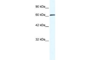 WB Suggested Anti-ZNF258 Antibody Titration:  0. (ZMYM6 抗体  (Middle Region))