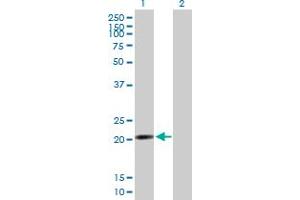 Western Blot analysis of RP13-383K5. (NUP62CL 抗体  (AA 1-184))
