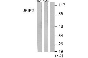 Immunohistochemistry analysis of paraffin-embedded human brain tissue using JKIP2 antibody. (JAKMIP2 抗体)