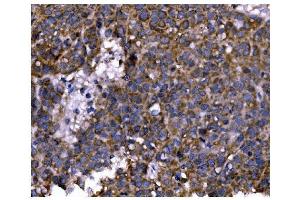 IHC analysis of PFKFB2 using anti-PFKFB2 antibody (ABIN7601627). (PFKFB2 抗体  (AA 4-505))