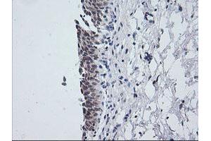 Image no. 3 for anti-NFKB Inhibitor Interacting Ras-Like 1 (NKIRAS1) antibody (ABIN1499742)