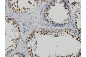 Immunoperoxidase of monoclonal antibody to PBK on formalin-fixed paraffin-embedded human testis. (PBK 抗体  (AA 1-110))