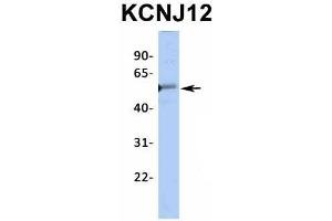 Western Blotting (WB) image for anti-Potassium Inwardly-Rectifying Channel, Subfamily J, Member 12 (KCNJ12) (Middle Region) antibody (ABIN2776235)