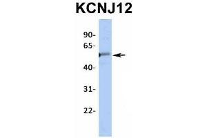 Host:  Rabbit  Target Name:  KCNJ12  Sample Type:  Human Fetal Heart  Antibody Dilution:  1. (Kir2.2 抗体  (Middle Region))