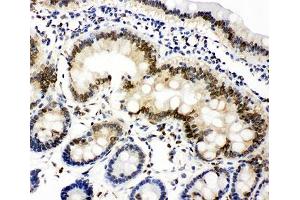 IHC-P: Lamin A/C antibody testing of rat intestine tissue