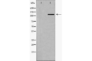 Western blot analysis of A549 whole cell lysates, using SLC4A4 Antibody. (SLC4A4 抗体  (C-Term))